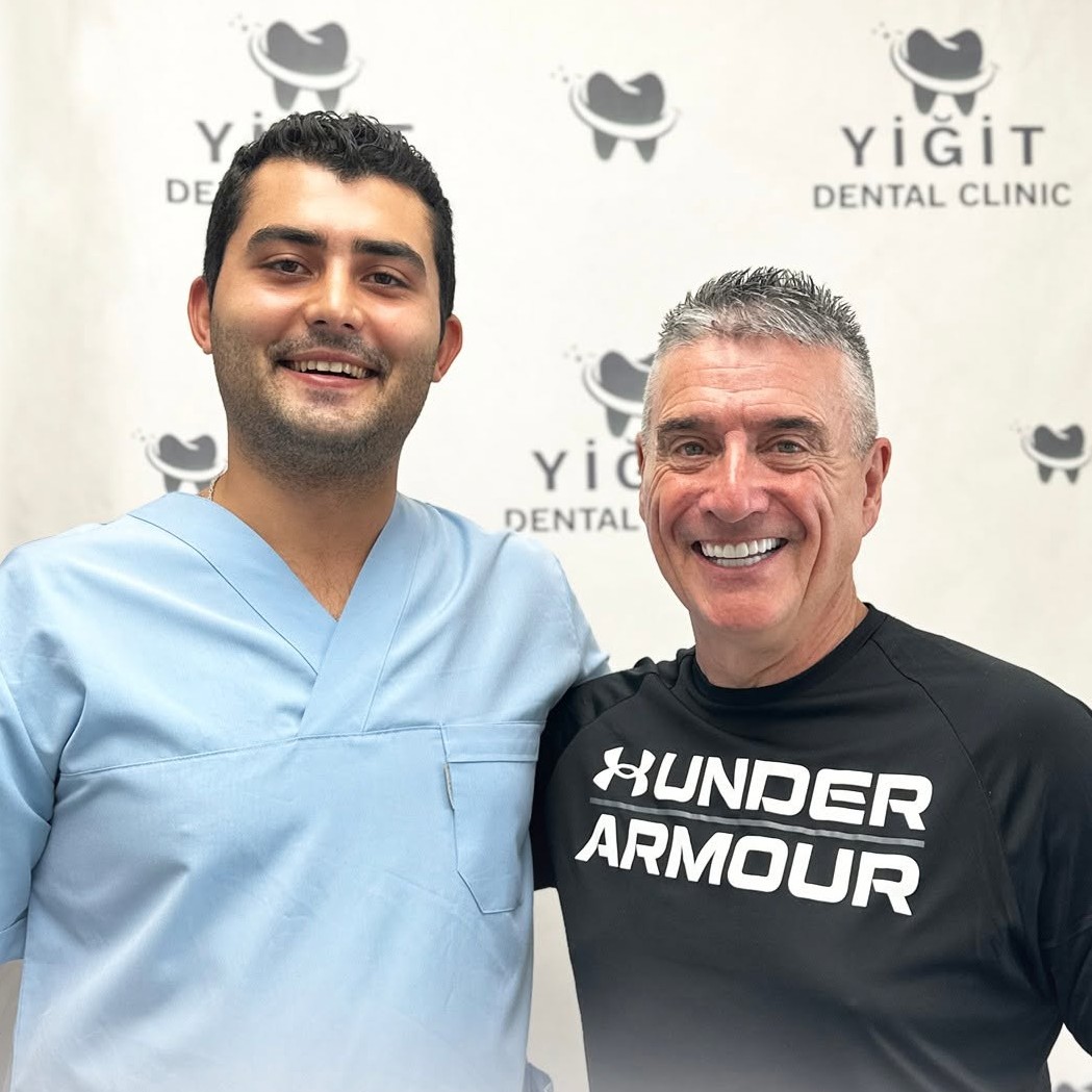 full mouth dental implants before after image